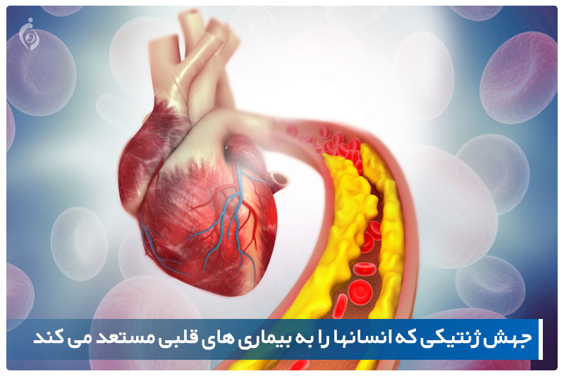 آترواسکلروز