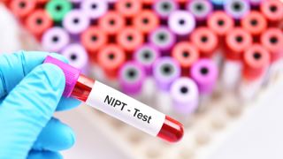 آزمایش پیش از تولد غیرتهاجمی (NIPT یا سل فری) چیست و چه بیماری‌هایی را غربالگری می‌کند؟