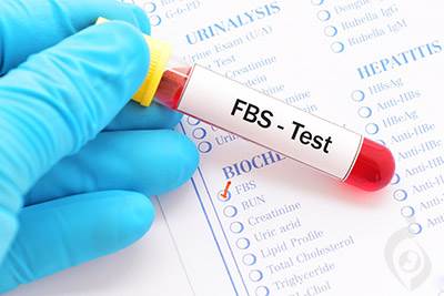 آزمایش قند خون ناشتا (FBS)