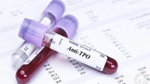 آزمایش آنتی بادی ضد پراکسیداز تیروئیدی Anti-TPO