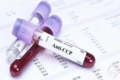 آزمایش آنتی بادی علیه پپتید سیترولینه حلقوی (Anti-CCP)
