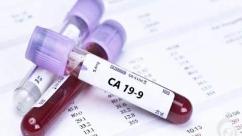 آزمایش تومور مارکر CA19-9 (آنتی ژن سرطانی 9-19)