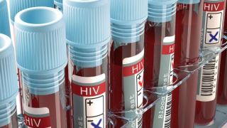 واکسن HIV به زودی بر روی نمونه های انسانی تست می شود
