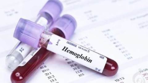 آزمایش هموگلوبین (Hgb، Hb)