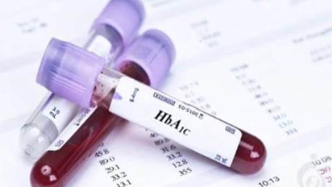 آزمایش هموگلوبين گليکوزيله (HbA1C) ، گلیکوهموگلوبین (GHb)
