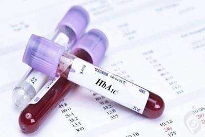 آزمایش هموگلوبين گليکوزيله (HbA1C) ، گلیکوهموگلوبین (GHb)