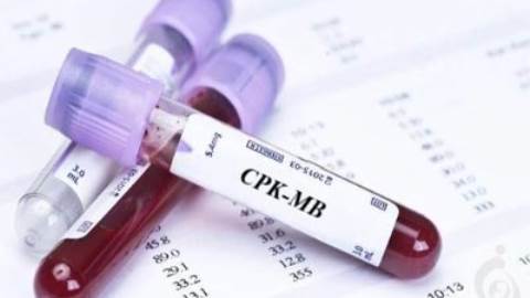 آزمایش کراتینین فسفوکیناز (CPK-MB)