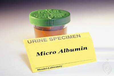 آزمایش میکروآلبومین (MA)