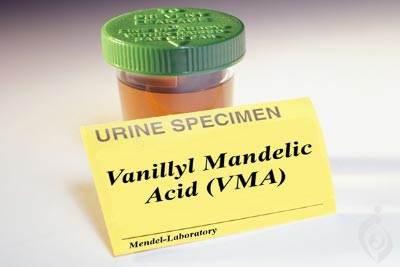 آزمایش وانیلیل مندلیک اسید (VMA)