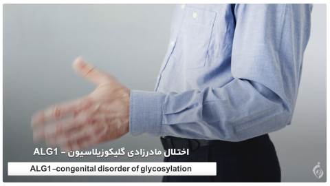 اختلال مادرزادی گلیکوزیلاسیون - ALG1