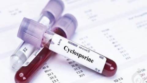 آزمایش سیکلوسپورین خون (CSA)، نئورال، ساندیمون