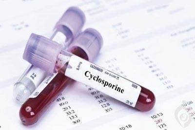 آزمایش سیکلوسپورین خون (CSA)، نئورال، ساندیمون