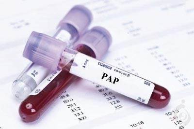 تست اسید فسفاتاز پروستاتی (PAP)