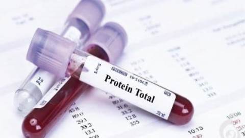 آزمایش پروتئین توتال (PT)