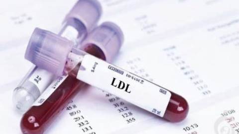 آزمایش کلسترول لیپوپروتئین با وزن مولکولی پایین (LDL)