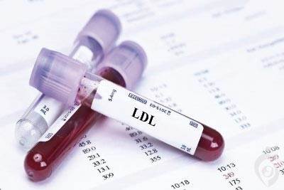 آزمایش کلسترول لیپوپروتئین با وزن مولکولی پایین (LDL)