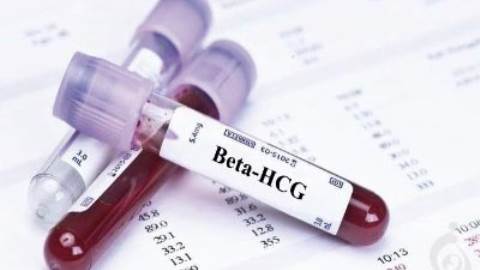 آزمایش بتا بارداری -  تست بتا HCG -  گنادوتروپین جفتی انسان - زیر واحد بتا (Beta-hCG)