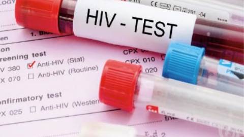 تشخیص مولکولی ایدز HIV