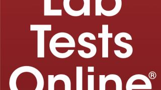 آزمایش آنلاین و هدف از انجام آزمایش به صورت آنلاین