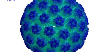 بیماری ناشی از عفونت HPV (اچ پی وی) چیست و درمان آن چگونه است؟
