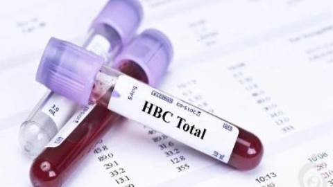آزمایش (HBc Ab (Total , آنتی بادی تام ضد آنتی ژن هسته ویروس هپاتیت B