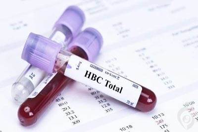 آزمایش (HBc Ab (Total , آنتی بادی تام ضد آنتی ژن هسته ویروس هپاتیت B