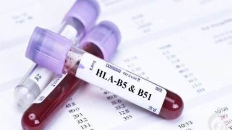 آنتی ژن لکوسیت انسانی HLA-B5 , HLA-B51