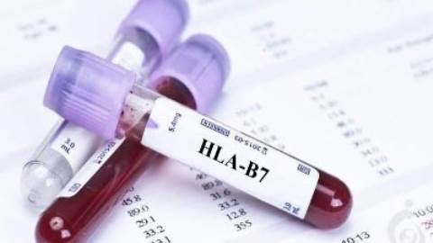 آنتی ژن HLA-B7