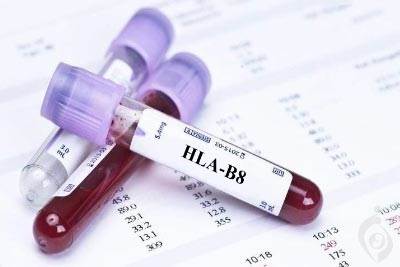 آنتی ژن HLA-B8