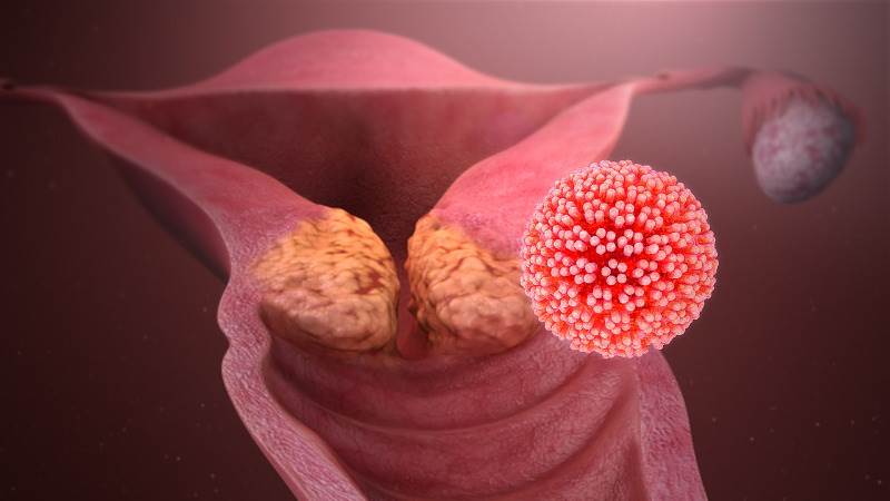 آزمایش HPV و مزایای آن