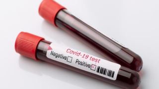 آزمایش خون برای تشخیص سریع کرونا را انجام دهید!