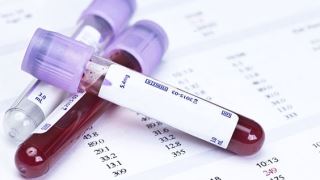 آزمایش خون برای ویروس کرونا در منزل یا محل کار