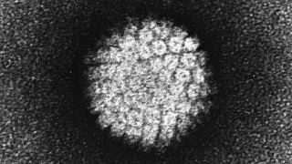 ویروس HPV و هر آنچه که باید از آزمایش اچ پی وی بدانید!