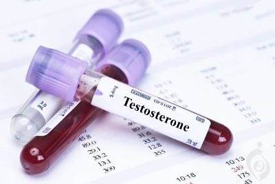 آزمایش هورمون تستوسترون (Testosterone)
