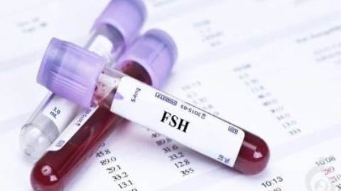 آزمایش هورمون محرک فولیکول (FSH)