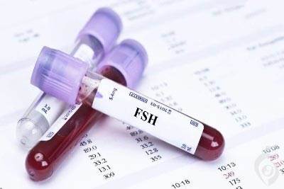 آزمایش هورمون محرک فولیکول (FSH)