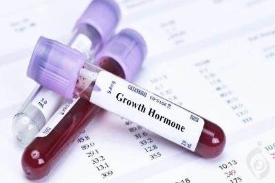 آزمایش هورمون رشد (GH) , هورمون سوماتوتروپین