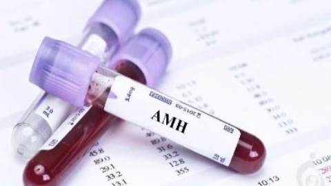 آزمایش هورمون آنتی مولرین (AMH)