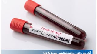 آزمایش خون کرونا چیست و چگونه باید این آزمایش را انجام دهید؟