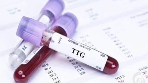 آزمایش آنتی بادی های IgA/IgG ترانس گلوتامیناز بافتی