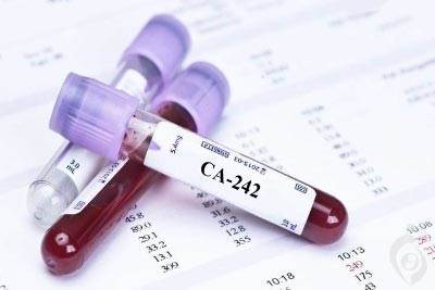 آزمایش آنتی ژن 242 سرطان پانکراس، تست کربوهیدرات آنتی ژن 242 تومور
