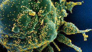 سلول تی تا 6 ماه بعد از ابتلا به ویروس کرونا در بدن مصونیت ایجاد می کند؟