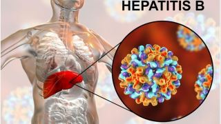 بیماری هپاتیت ب چیست و علائم آن را بشناسید!