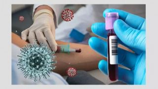 پلاسما درمانی برای بیماران مبتلا به ویروس کرونا