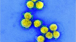 محققان انواع جدید ویروس COVID-19 را در سه استان آفریقای جنوبی کشف کردند!