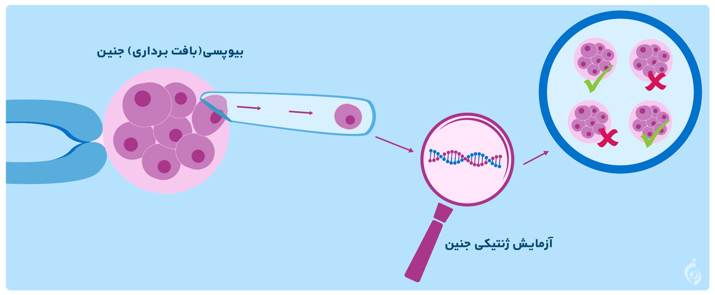 مراحل PGD