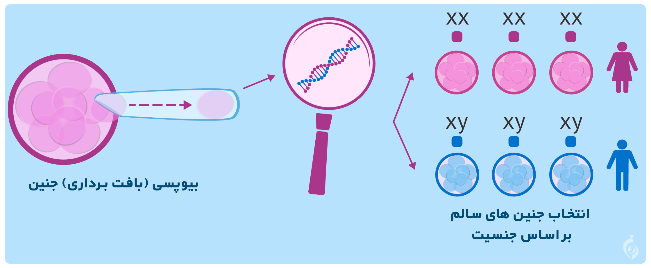 تعیین جنسیت به روش PGD