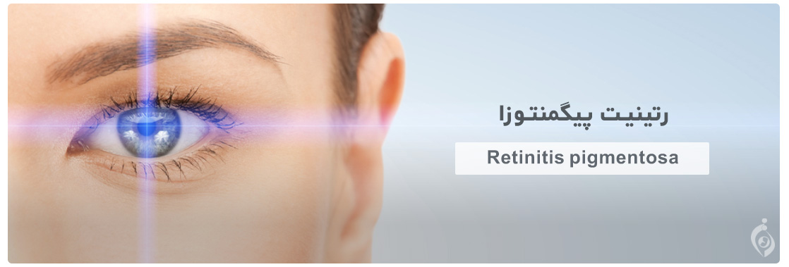 رتینیت پیگمنتوزا (Retinitis pigmentosa)