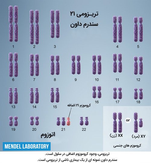 تریزومی