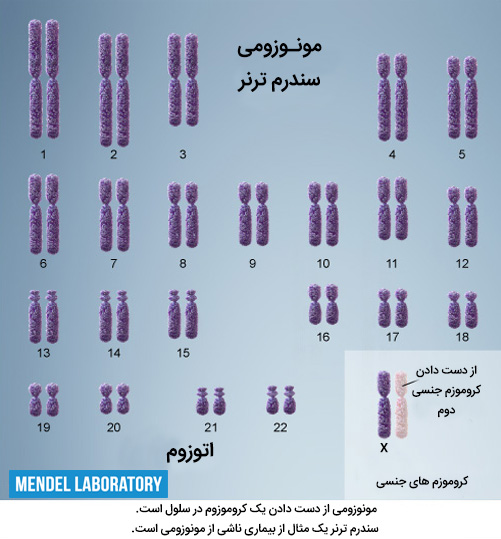 مونوزومی